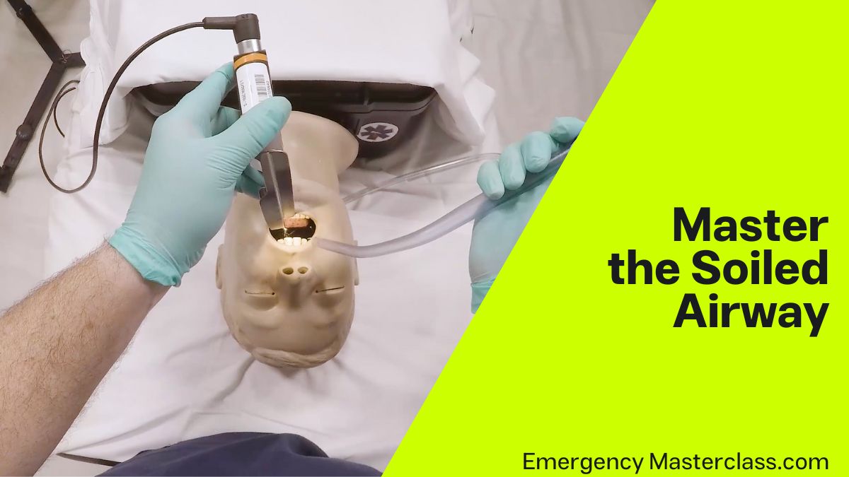 The SALAD Technique – an Emergency Airway Masterclass with Jim DuCanto